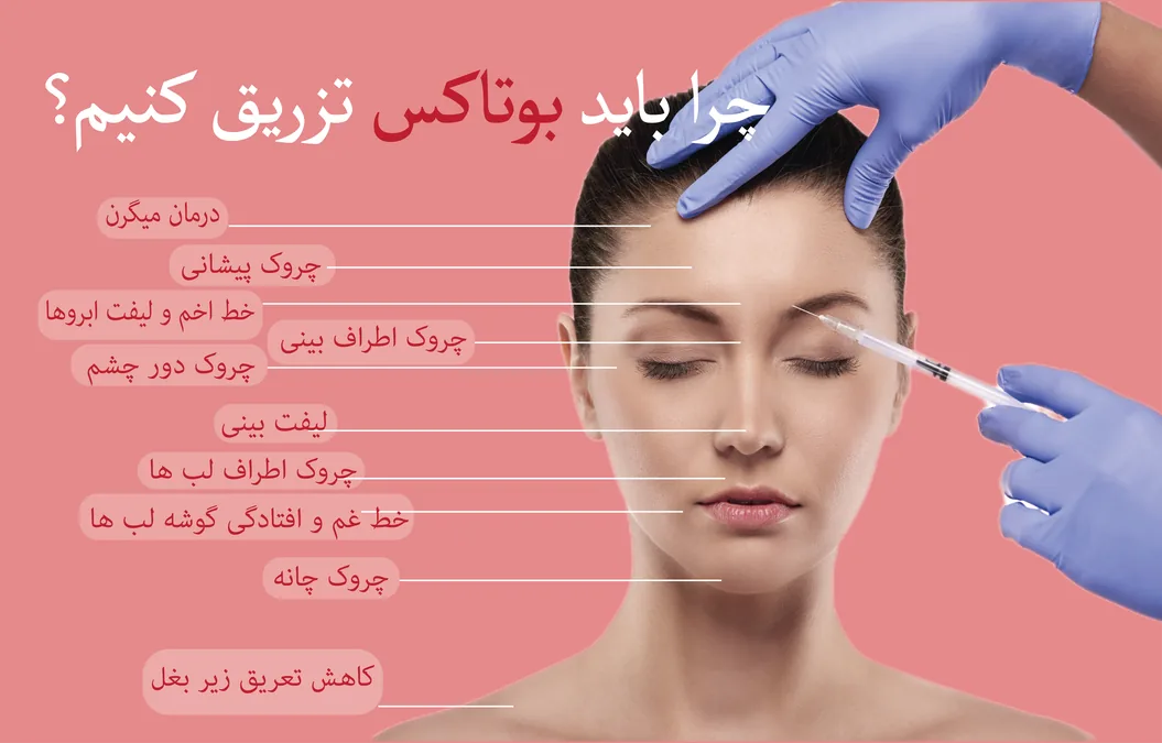 بوتاکس پیشانی و دور چشم | زمان اثر، ماندگاری، مراقبت‌ها