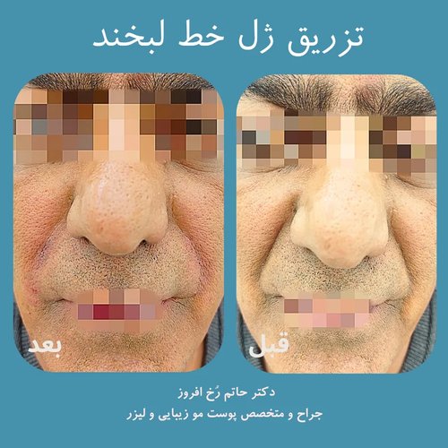 رفع خط اندوه